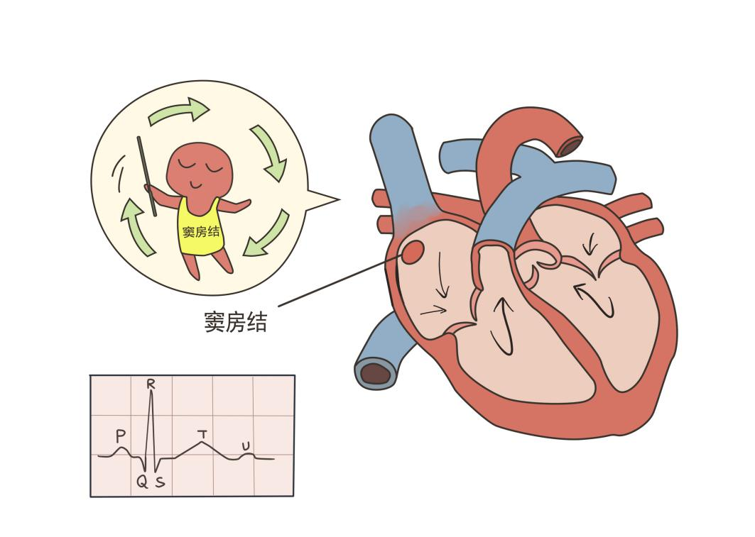 塑心学堂 | 心电图“T波异常”是什么意思？